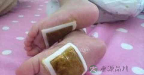 穴位贴敷治疗贴使用方法
