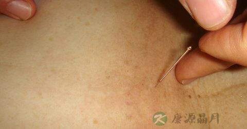 小儿麻痹症疫苗是什么