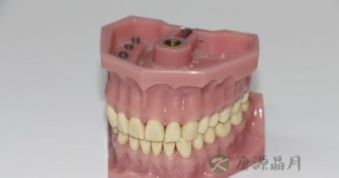 牙套要戴多久