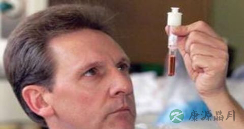 血糖尿糖正常指标