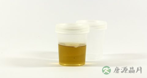 糖尿病的标准血糖