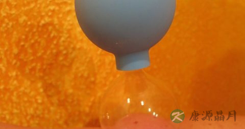 糖尿病的拔罐疗法