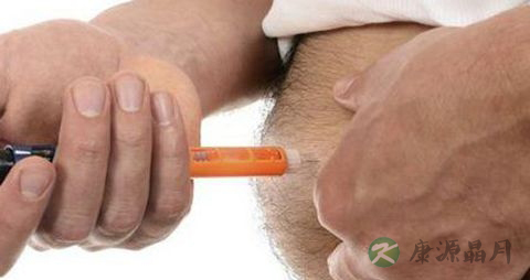 糖尿病是伴性遗传吗