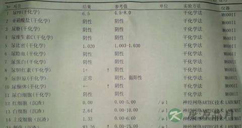 教你如何看懂尿常规化验单