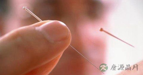 针灸能治疗糖尿病吗 糖尿病人怎么针灸