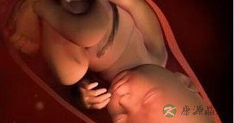 血糖过高对胎儿的影响吗