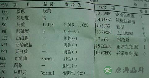 教你如何看懂尿常规化验单