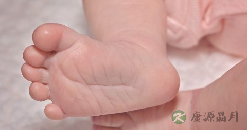新生儿糖尿病的病因以及检查有哪些