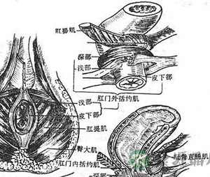 大便失禁