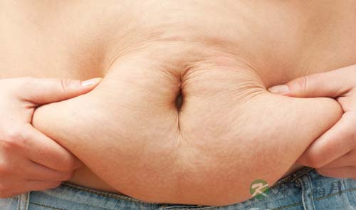 单纯性肥胖是什么意思