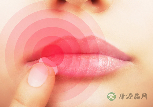口角炎的病因及治疗