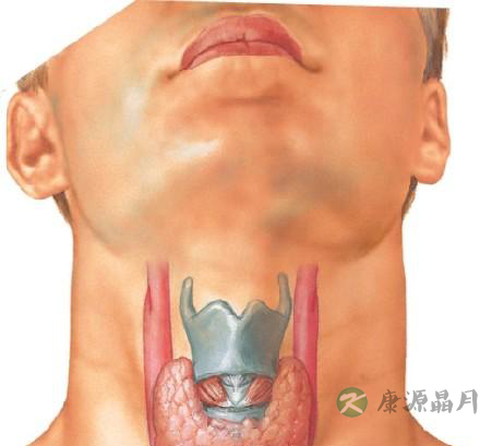 甲状腺腺瘤是什么