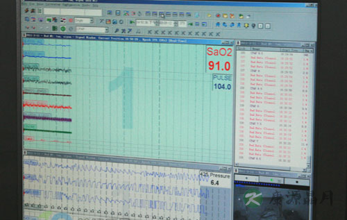 南方医院睡眠医学中心主任李涛平：打鼾是病 选对治疗方法才有效