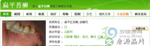 中医治疗口腔扁平苔癣效果好 中医治疗口腔扁平苔癣效果好