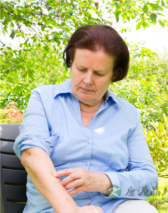 什么是划痕性荨麻疹：怎么治划痕性荨麻疹？