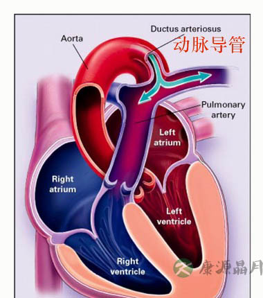 彭帅曾患先心病 心脏被植入六根弹簧