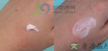 8种抗真菌药膏横向对比报告