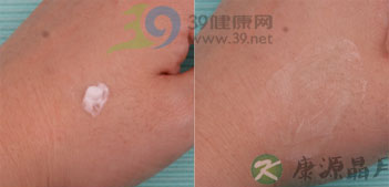 8种抗真菌药膏横向对比报告