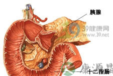 如何发现踪迹 揪出胰腺癌 如何发现踪迹 揪出胰腺癌