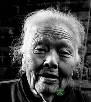 老年妇女常查甲状腺