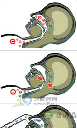 看看你的打呼噜会否梦中夺命? 看看你的打呼噜会否梦中夺命?