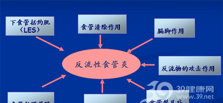 常觉烧心？查查是否为胃食管返流