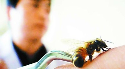 蜂毒可致过敏性休克 蜂毒可致过敏性休克