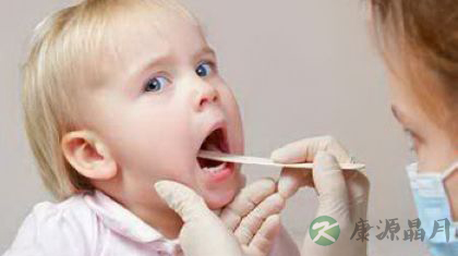 扁桃体发炎怎么回事 怎么治疗