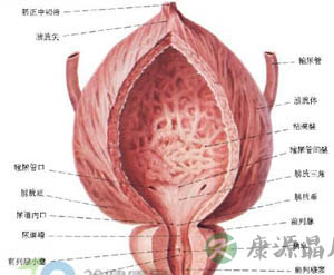 癌症图片：膀胱癌