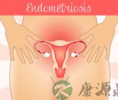 子宫有炎症会有什么症状