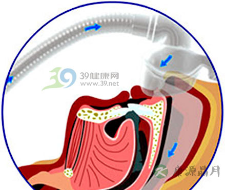 打呼噜=睡得香or憋死人？