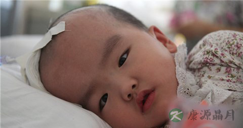 脑积水有什么危害？