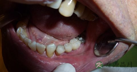 老人消化不好吃什么食物较好