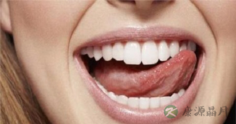 前牙反合的症状