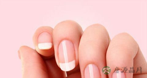 甲癣的症状