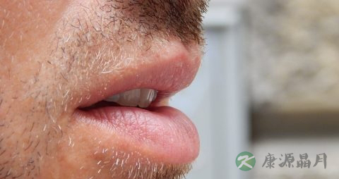 唇疱疹的症状