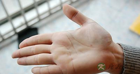 手心热吃什么药