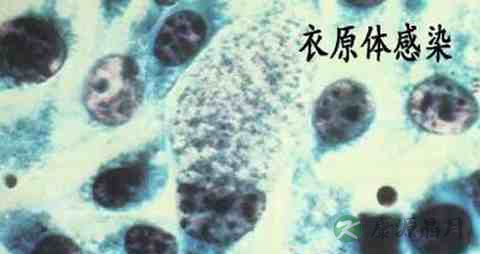 衣原体感染症吃什么药