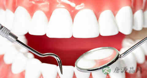 药物性牙龈增生吃什么药