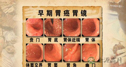 黑便吃什么药