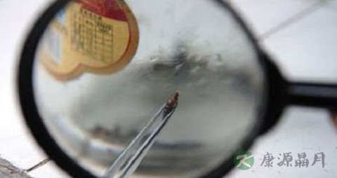 血吸虫病不能吃什么，血吸虫病的注意事项