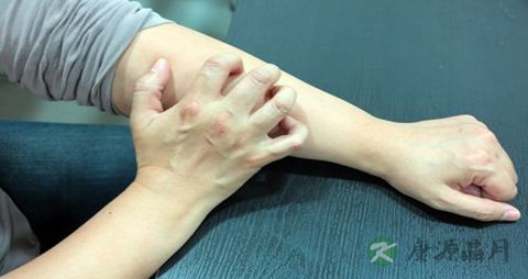 网球肘不能吃什么，网球肘的注意事项