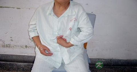 脑血栓不能吃什么，脑血栓的注意事项