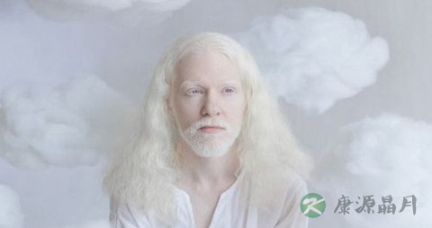 轻微白化病初期症状