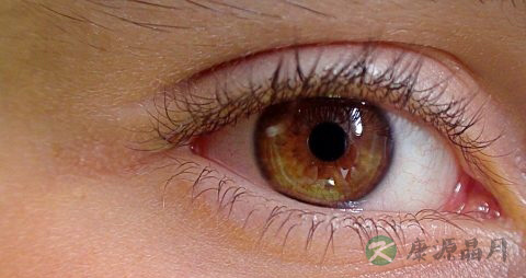 眼珠棕色就是白化病吗