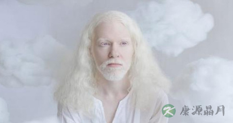 白化病是一种恶性肿瘤吗