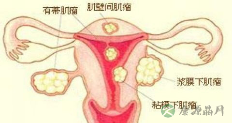 囊肿和肿瘤怎么区分