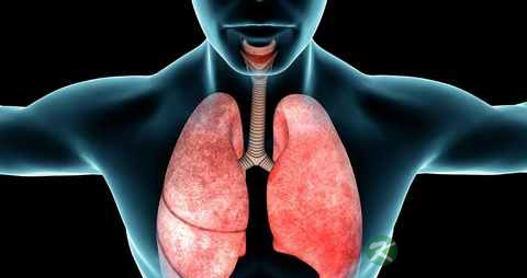 肺部肿瘤的预防应该怎么做
