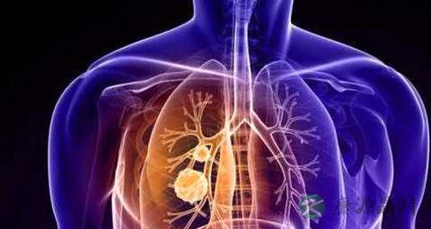 肺癌和肺鳞癌的区别