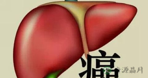 肝癌骨转移是肝癌几期